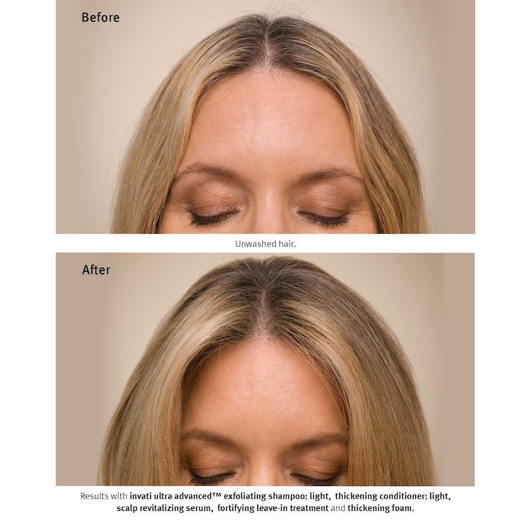 AVEDA Invati Ultra Advanced™ Revitalisant 150 ml