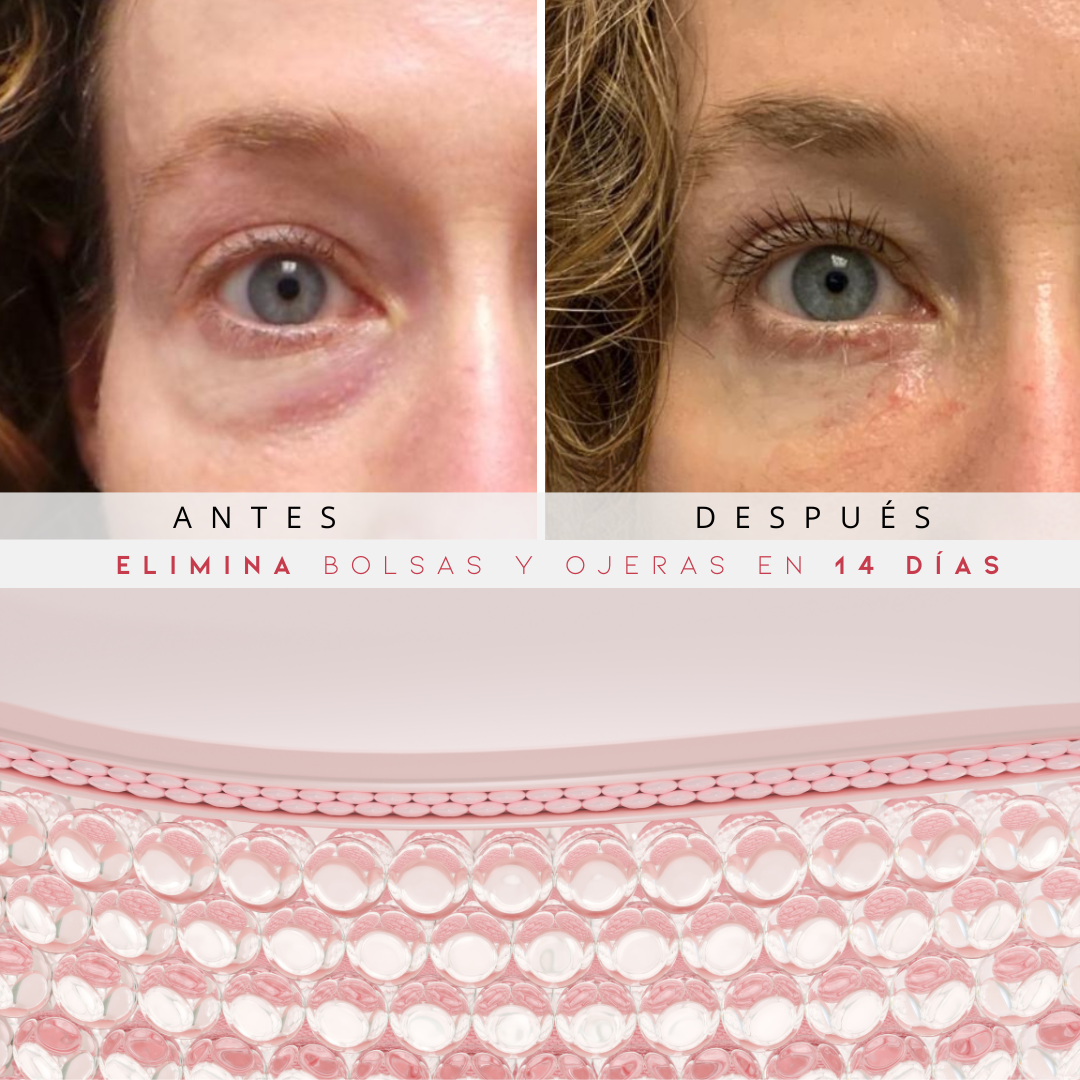 ETERNAS® Reparador Bolsas y Ojeras con LED y Microcorriente