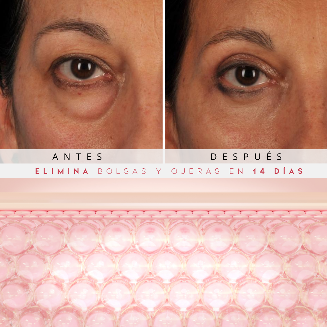 ETERNAS® Reparador Bolsas y Ojeras con LED y Microcorriente