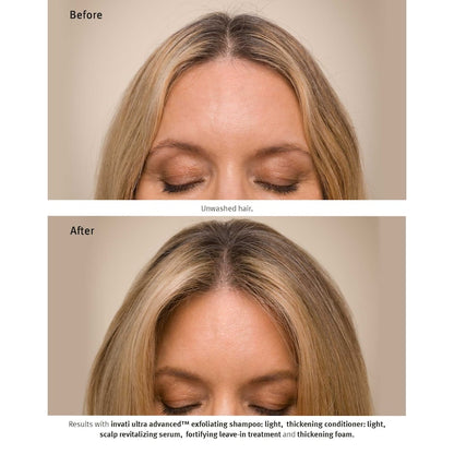 AVEDA Invati Ultra Advanced™ Revitalisant 150 ml