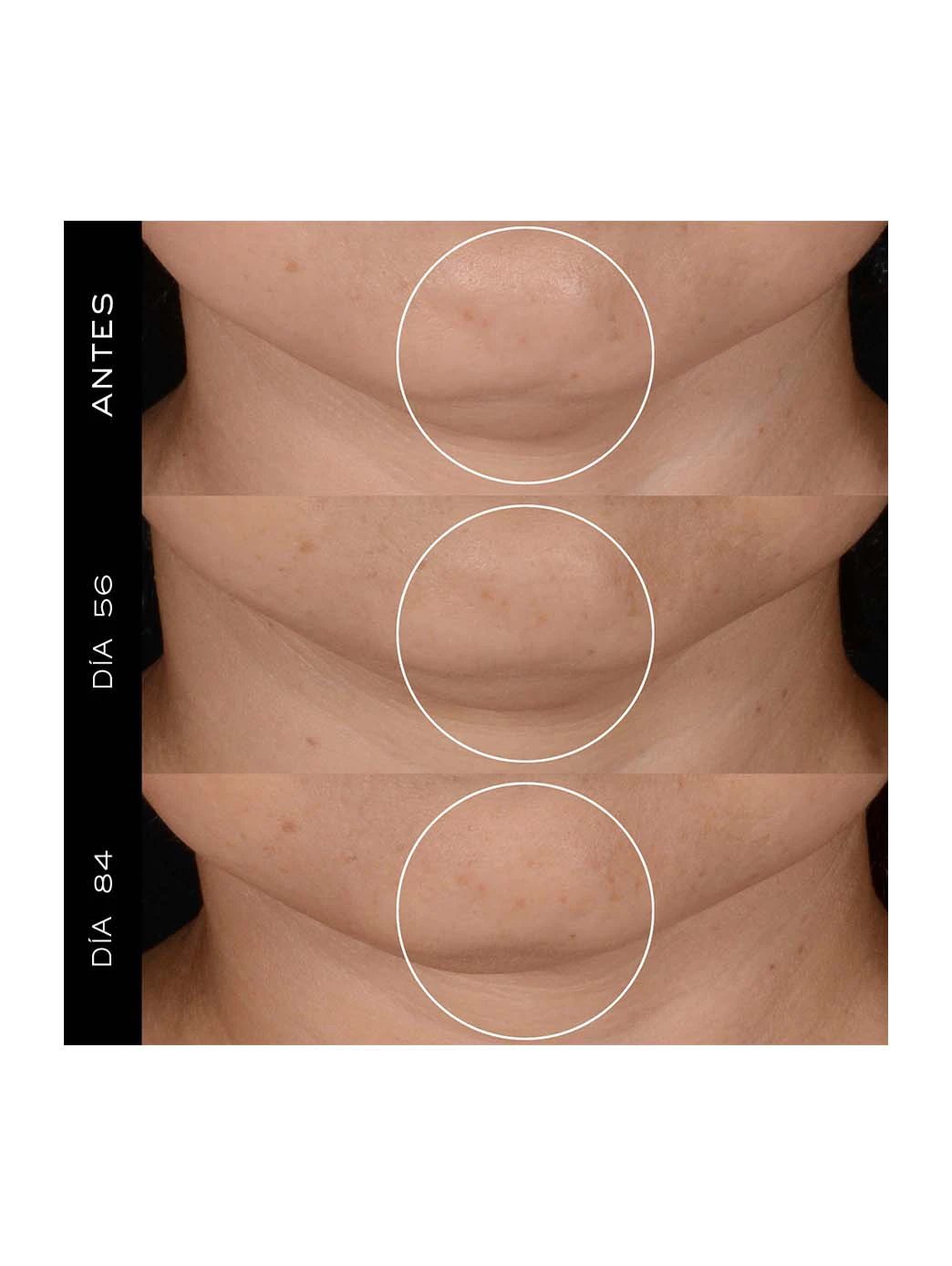 Rénergie H.P.N 300 -Peptide Cream by Perfumerías Padilla