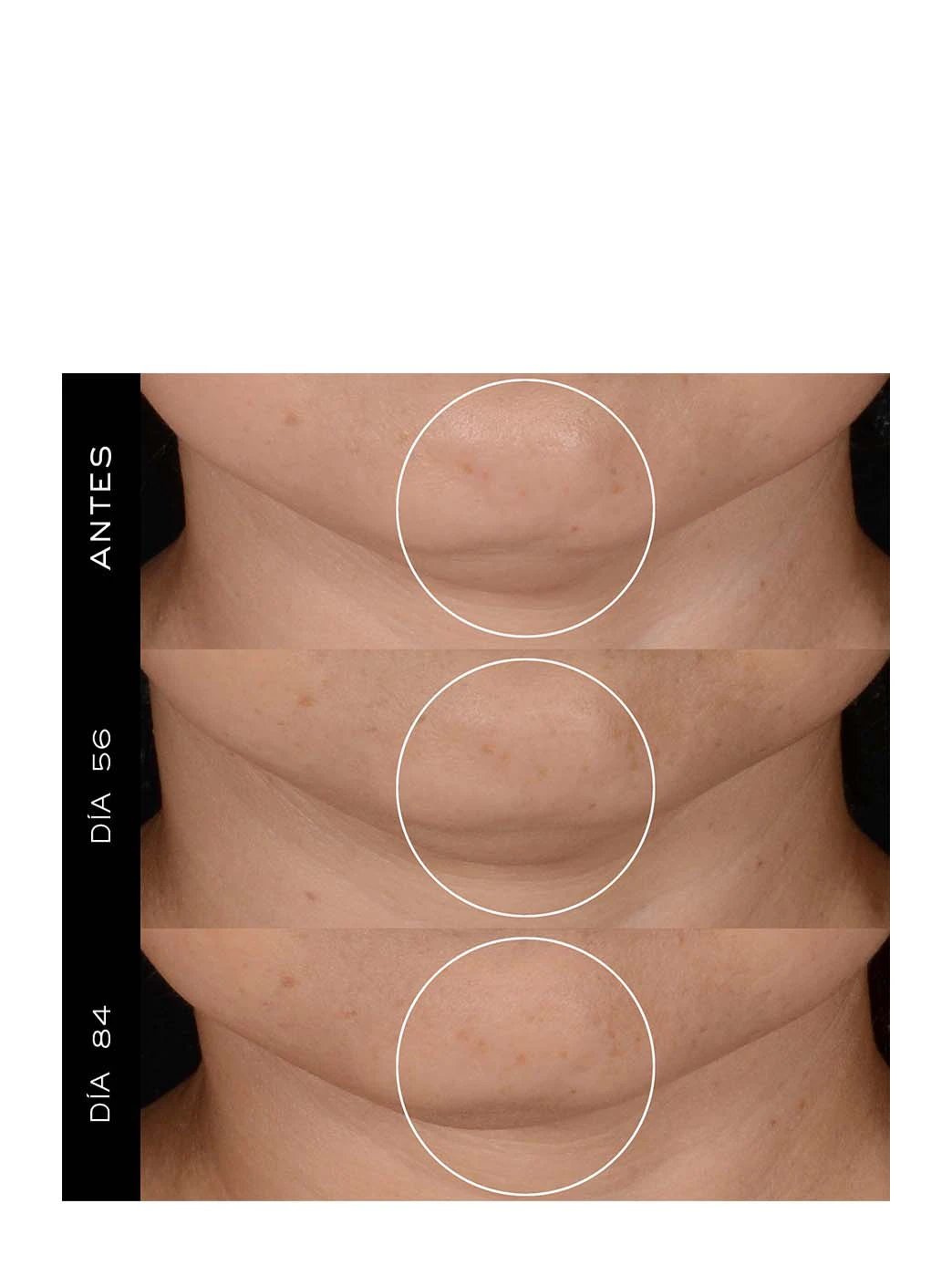 Rénergie H.P.N 300 -Peptide Cream by Perfumerías Padilla